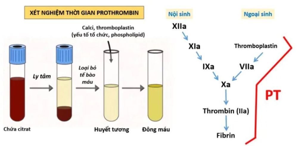 
Sơ đồ xét nghiệm thời gian prothrombin - PT
