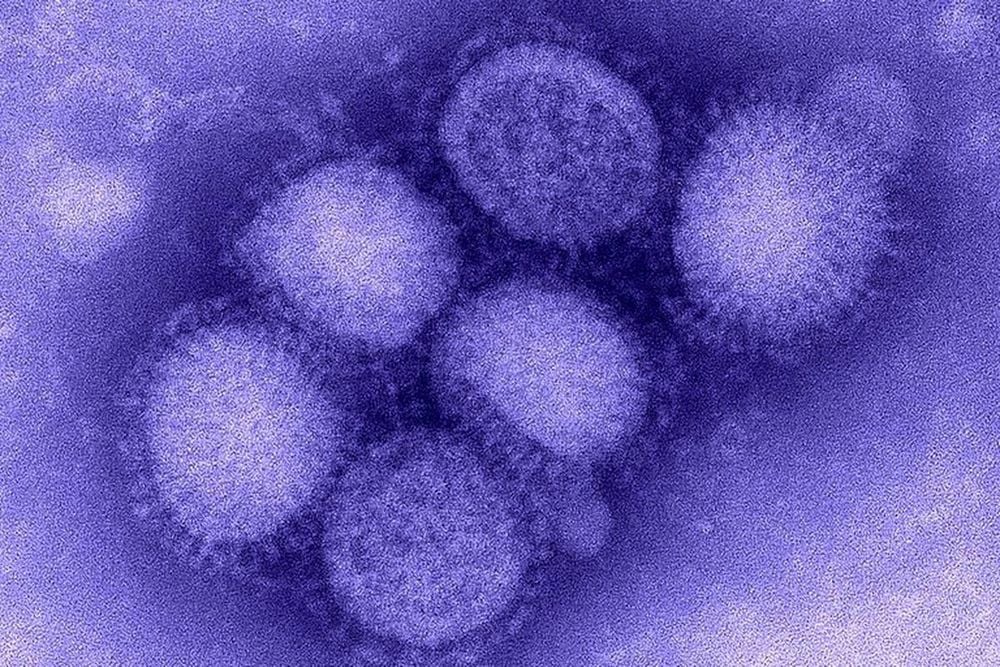 
Virus cúm là nguyên nhân gây viêm amidan
