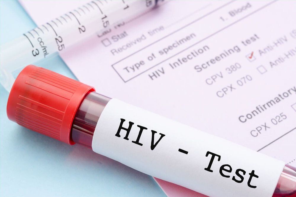 Các cặp vợ chồng cần xét nghiệm HIV trước khi làm IVF
