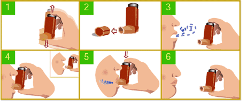 Inhaled inhaler in asthma control