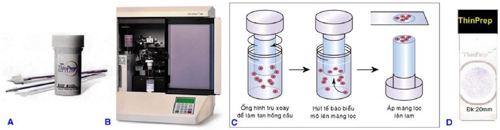 
Hinh 3: Lọ chứa 20ml dung dịch Thinprep (A); Máy tự động Thinprep (B); Quy trình hút tế bào lên màng lọc và áp lên lam (C); tiêu bản có một lớp mỏng tế bào hình tròn đường kính 20mm (D).
