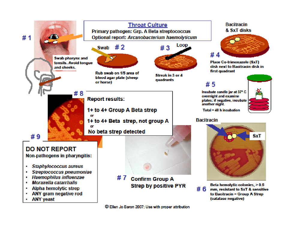 Meaning of throat swab test