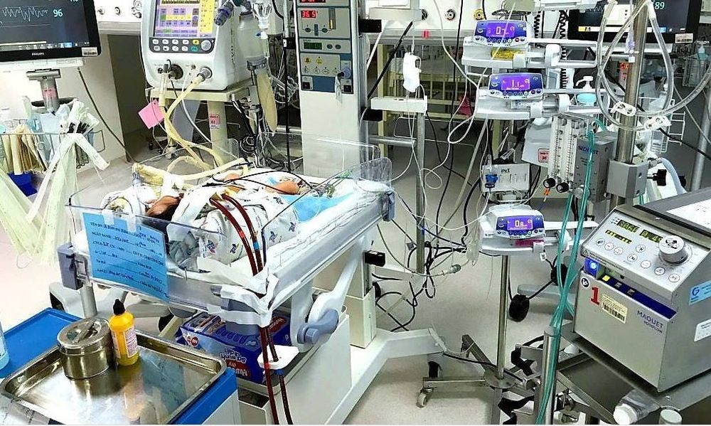 
Kỹ thuật ECMO giúp cứu sống nhiều trẻ nhỏ mắc vấn đề về sức khoẻ
