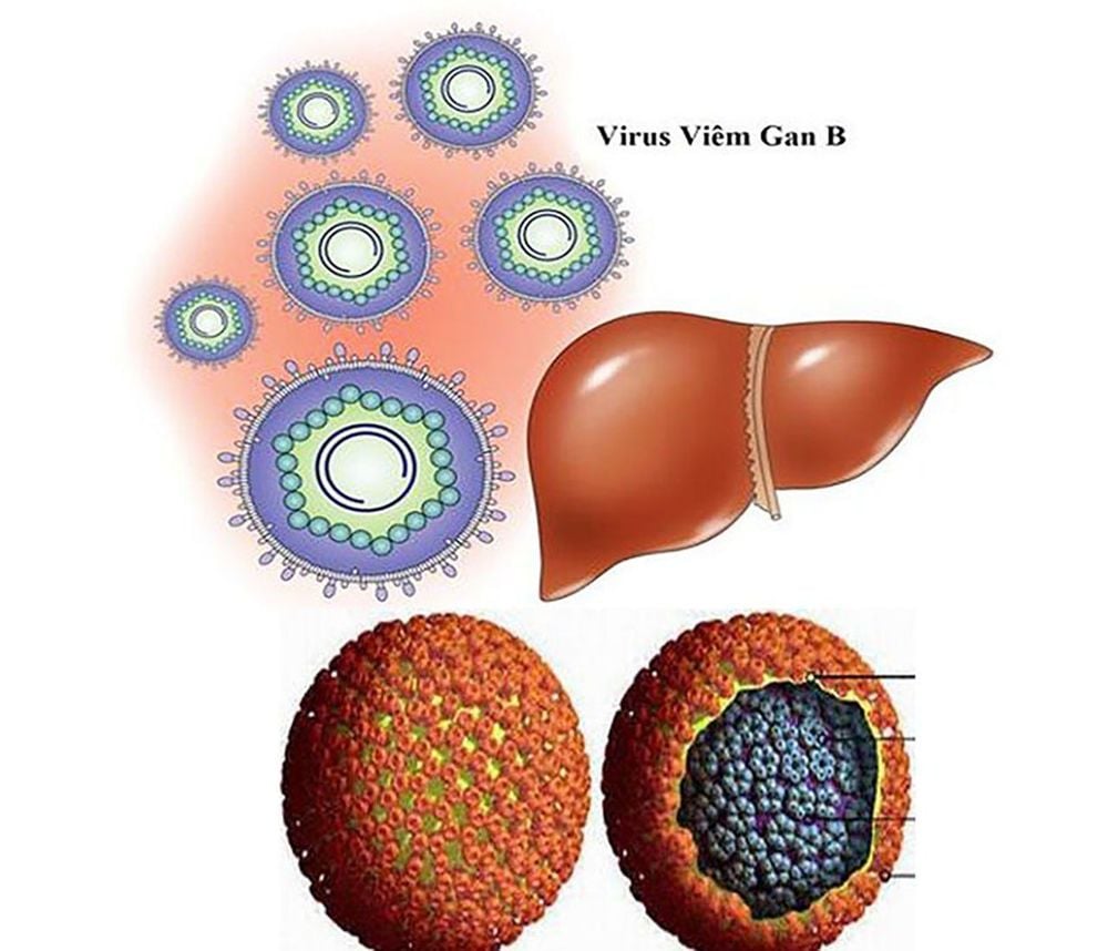 
Hình ảnh virus tuýp B gây bệnh viêm gan B
