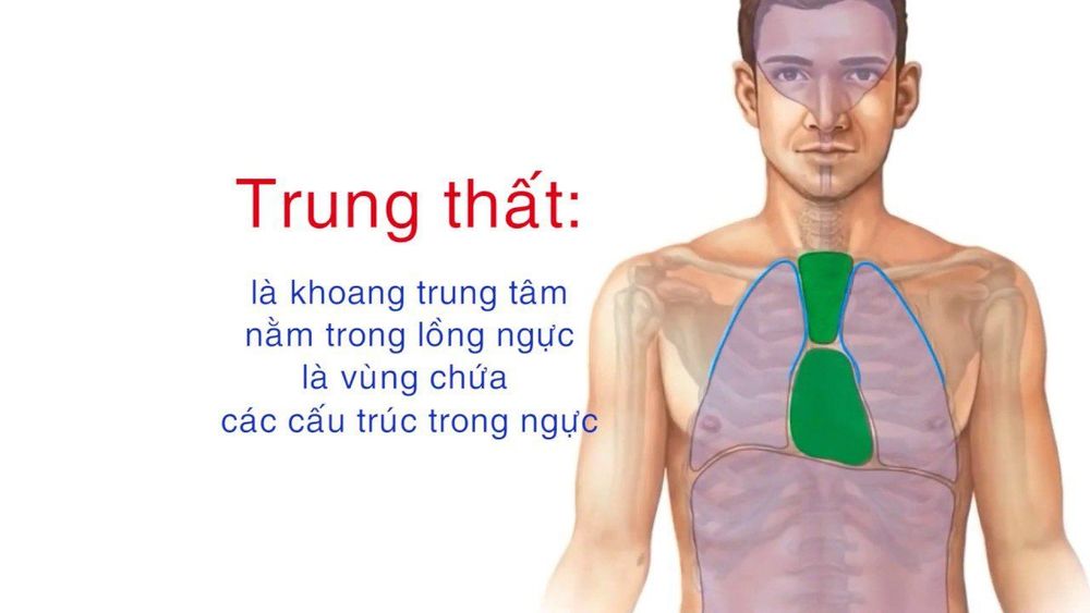 
U trung thất là căn bệnh rất phổ biến
