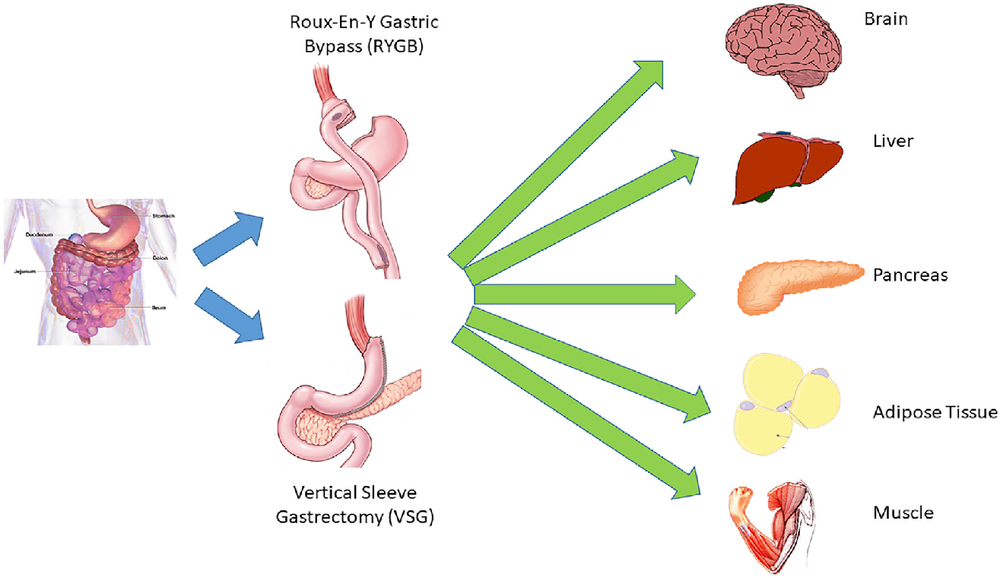 
Tác dụng đa chiều của phẫu thuật giảm cân đối với nhiều hệ thống cơ quan
