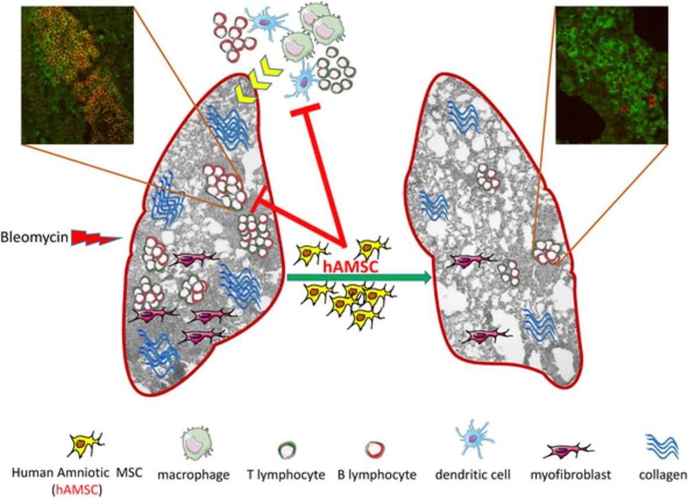 
Hình 1: Tác dụng của tế bào gốc trung mô từ màng ối (hAMSC) trong việc kiểm soát về mặt số lượng và hoạt động của tế bào lympho B và T trong điều trị xơ phổi. Nguồn tham khảo: Anna Cargnoni et al., 2020.
