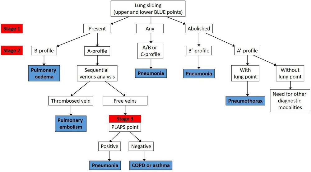 Vai trò của siêu âm phổi trong hồi sức cấp cứu