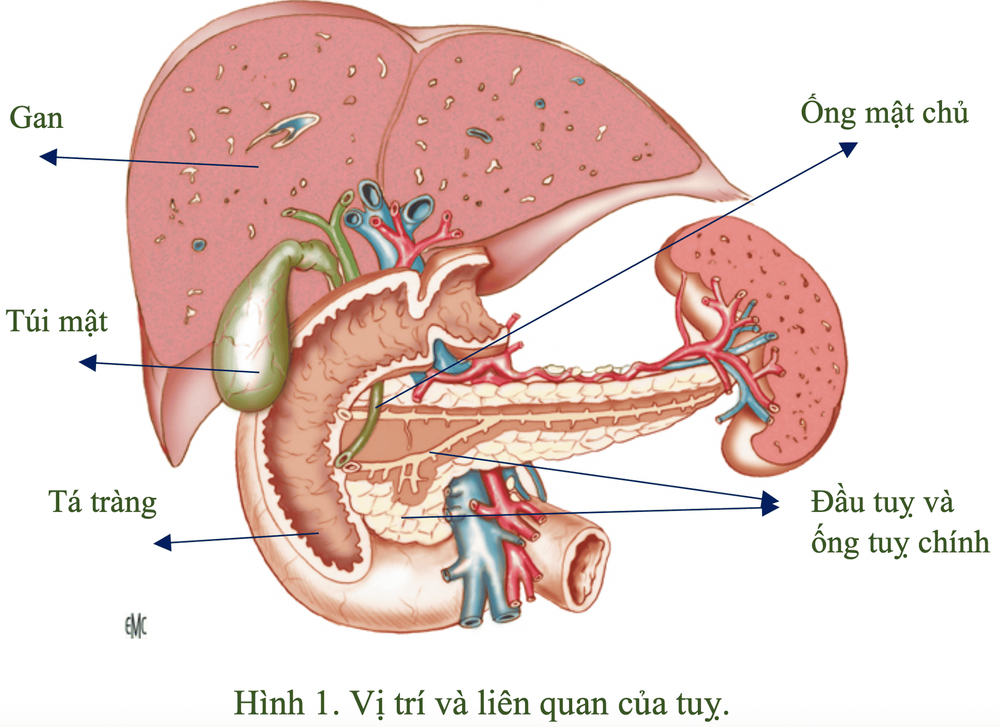 Ung thư tụy ngoại tiết: Biểu hiện, chẩn đoán, xử trí