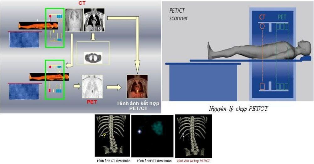 
Quy trình chụp PET/CT
