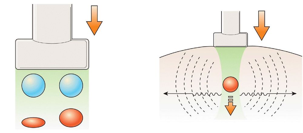 
Siêu âm phần mềm giúp bác sĩ quan sát được cấu trúc tổ chức cơ, gân, dây chằng nhanh chóng và dễ dàng nhất
