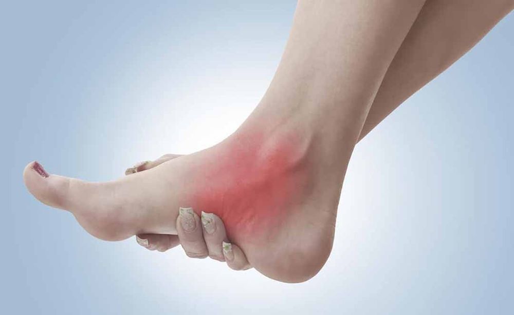 
Bệnh viêm khớp charcot ảnh hưởng trực tiếp đến việc đi lại của người bệnh
