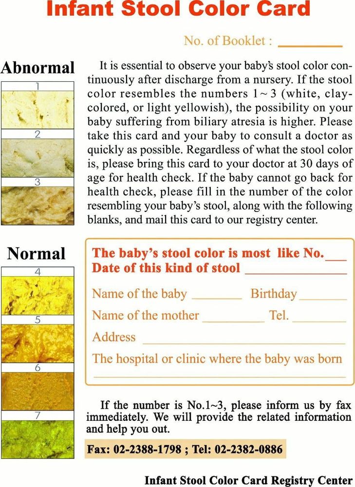 Screening for congenital biliary atresia in newborns