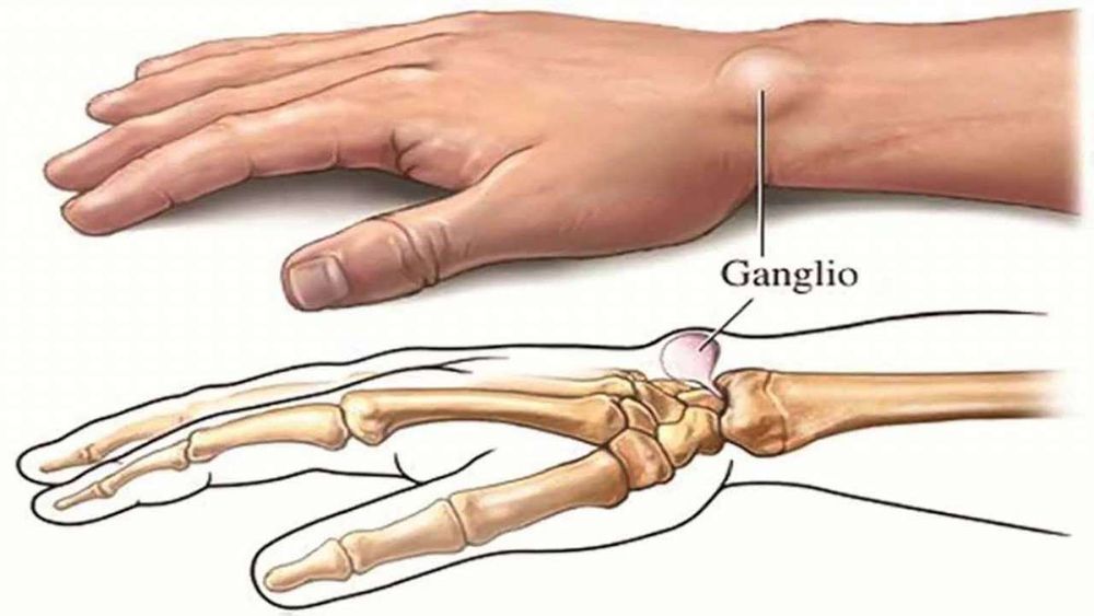 
Xạ hình xương cho phép phát hiện tình trạng ung thư đã di căn đến xương.
