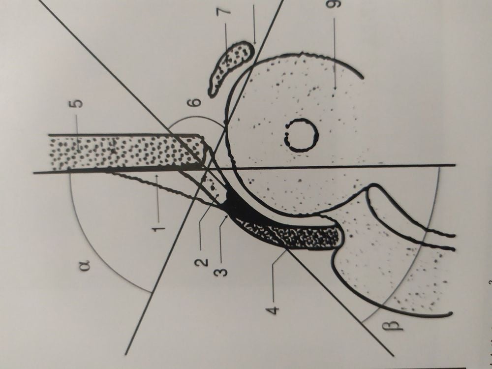 
Góc alpha và góc Beta trong việc xác định trật khớp háng ở trẻ
