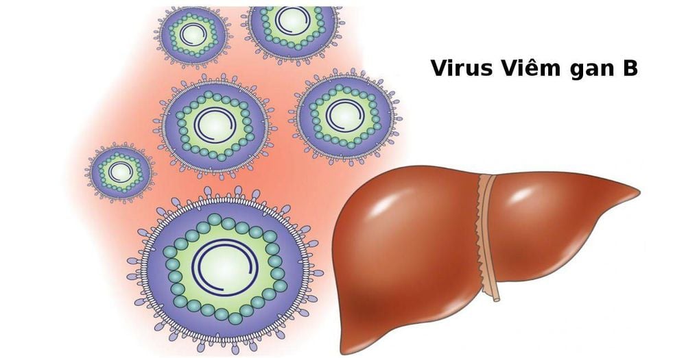 
Viêm gan B là một bệnh nhiễm trùng ở gan do virus gây ra
