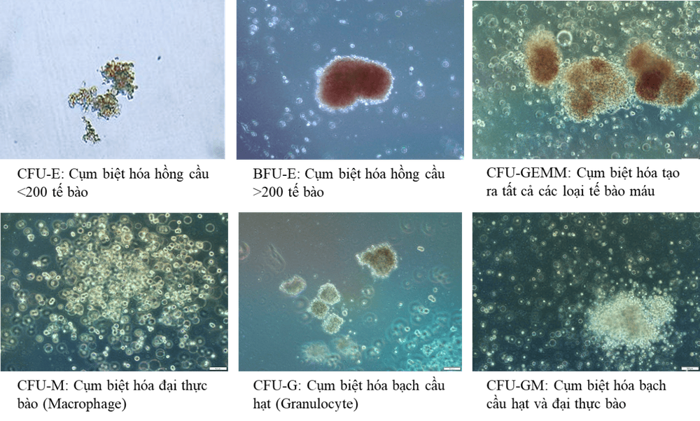 
Hình 1. Đặc điểm hình thái, màu sắc của các cụm biệt hóa từ tế bào gốc tạo máu
