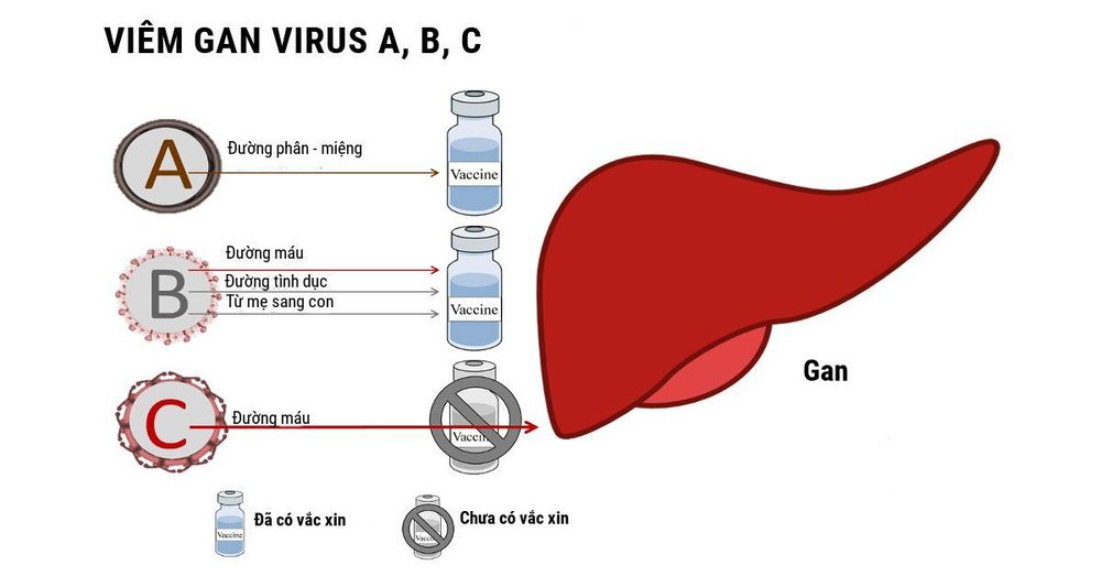 
Đến nay vẫn chưa có vacxin phòng viêm gan C nên việc phòng tránh các nguy cơ lây nhiễm là điều rất cần thiết mà mỗi người cần chủ động tìm hiểu
