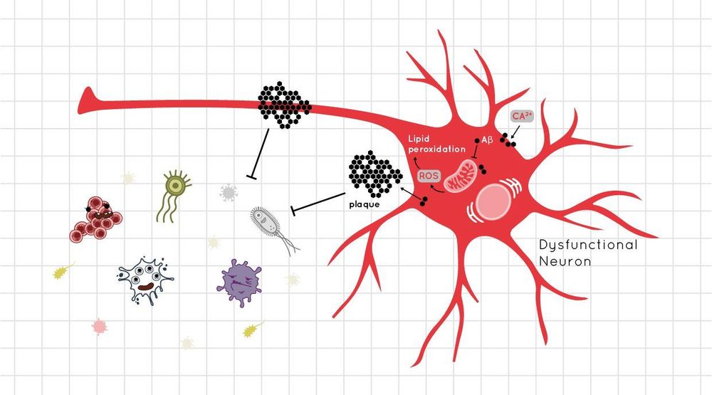 
Peptide amyloid-beta (Aβ) khiến người bệnh mất trí nhớ
