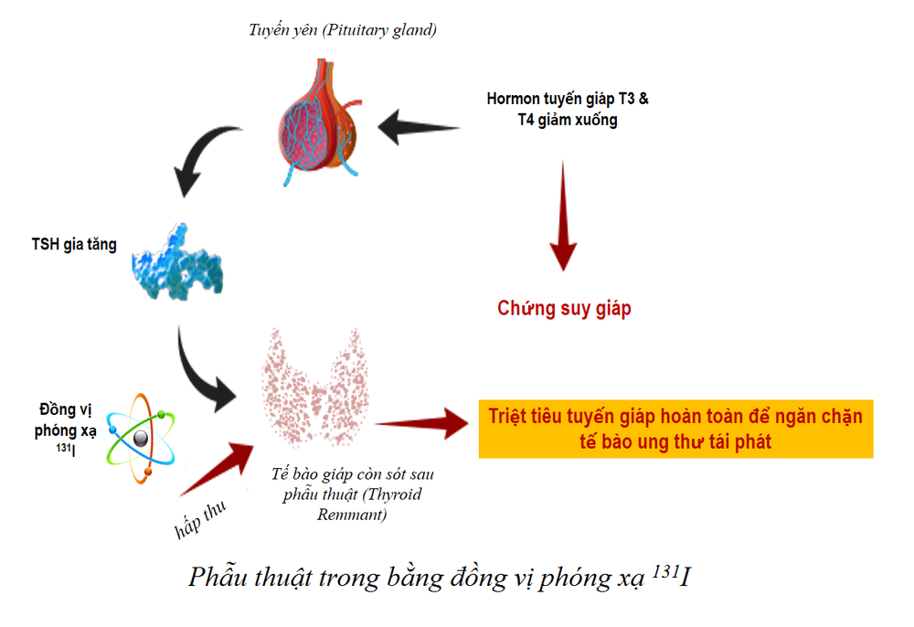 
Phẫu thuật trong bằng đồng vị phóng xạ
