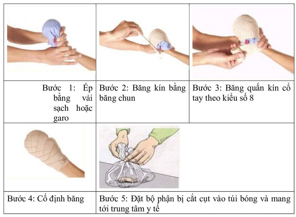 Wound first aid: What you need to know