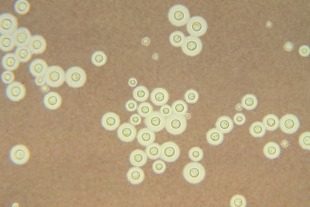 
Hình ảnh nấm phổi Cryptococcus
