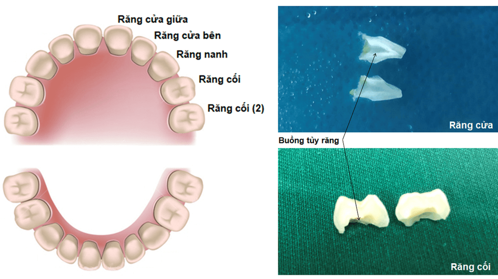 Learn about the process of storing milk tooth pulp stem cells