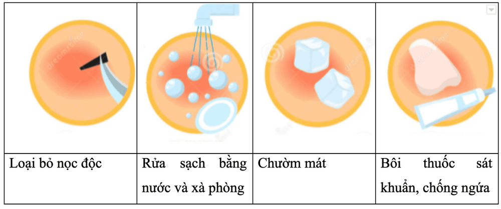 
Sơ cứu vết côn trùng chích đốt
