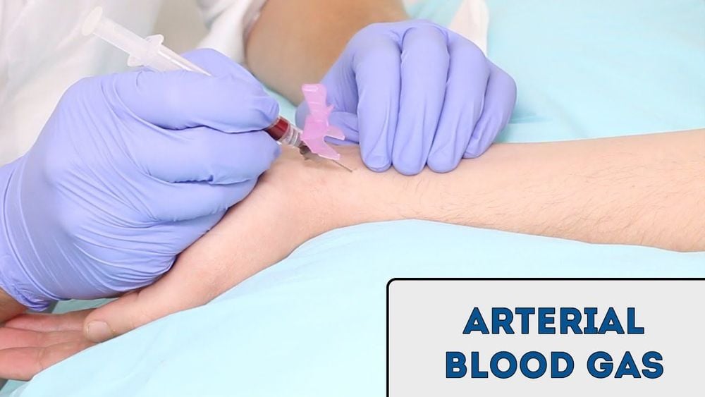 
Chỉ số SaO2 được đo bằng cách đo khí máu động mạch (arterial blood gas).
