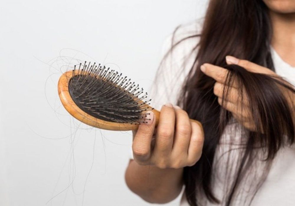 Rụng tóc là một tình trạng tự miễn dịch thường thấy với các bệnh tuyến giáp