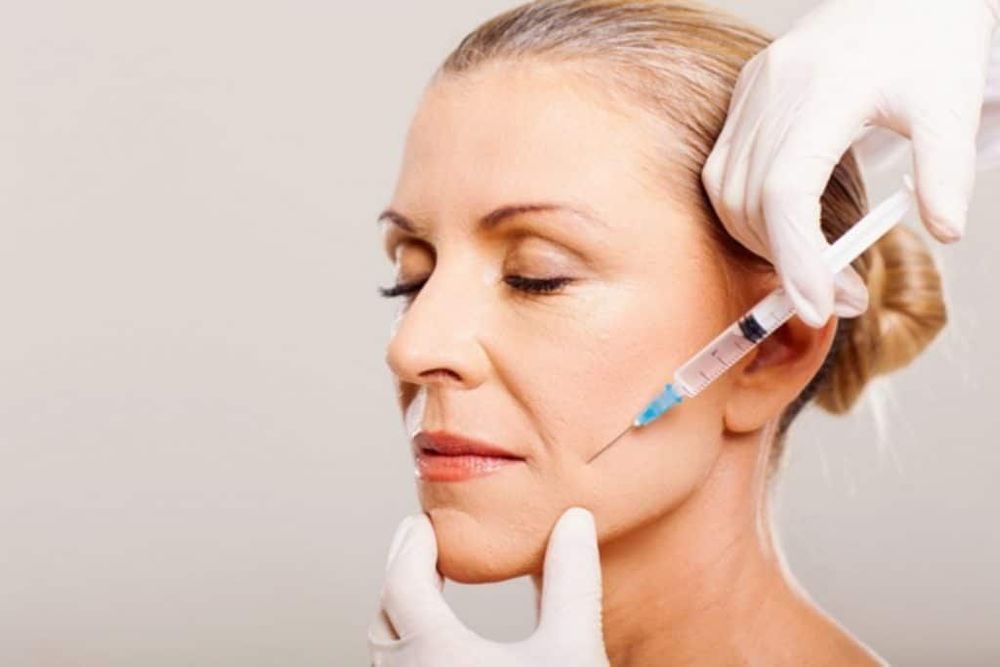 
Tiêm Botox® giúp cải thiện nếp nhăn khoé miệng
