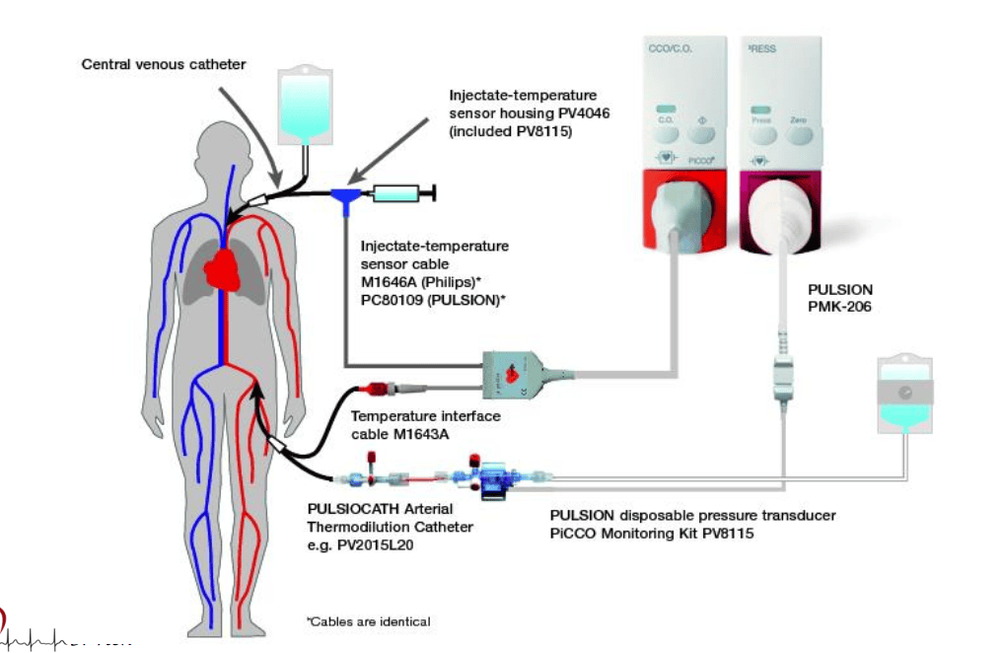 Applications of PiCCO technique in the treatment of Shock