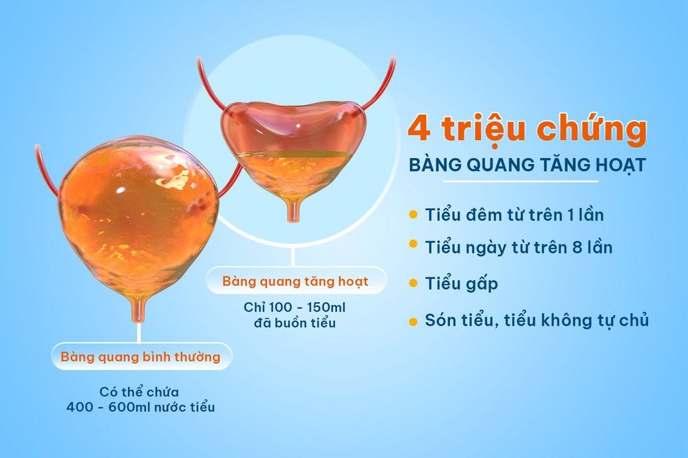 Hướng dẫn cải thiện hội chứng bàng quang tăng hoạt an toàn, hiệu quả