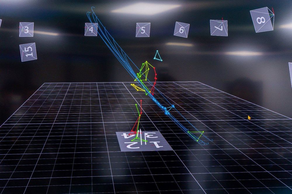 
Vinmec trang bị hệ thống Motion Lab tiên tiến – thường chỉ có tại các trung tâm y tế hàng đầu trên thế giới
