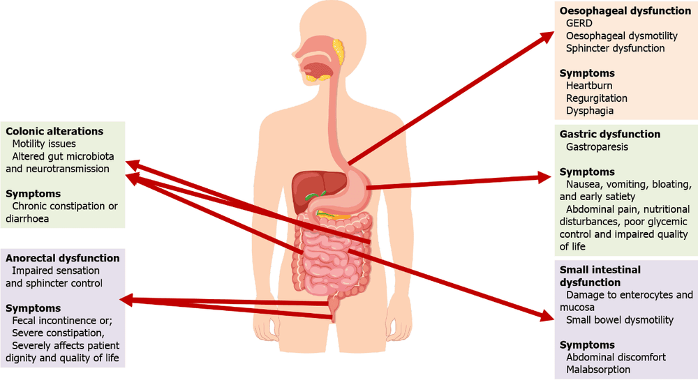 Tác động của bệnh thần kinh ruột do tiểu đường lên đường tiêu hóa