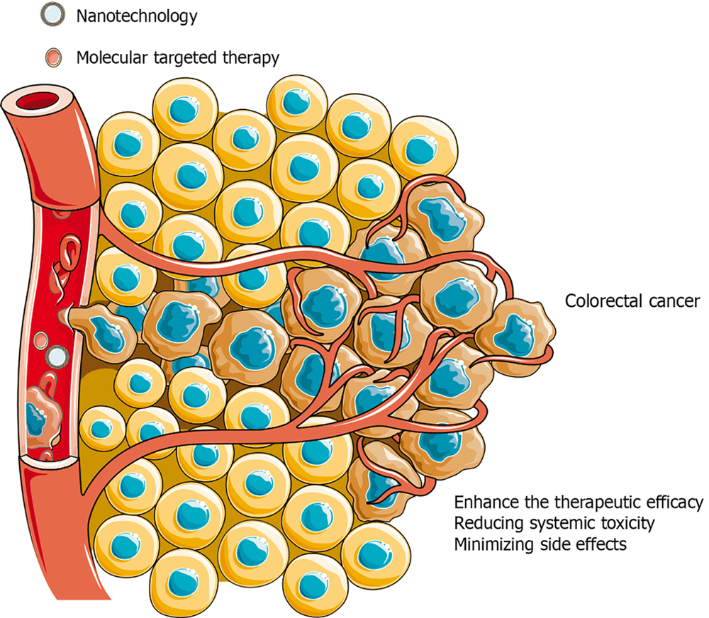 Phương pháp điều trị ung thư trực tràng tiên tiến: Công nghệ nano và liệu pháp nhắm mục tiêu phân tử