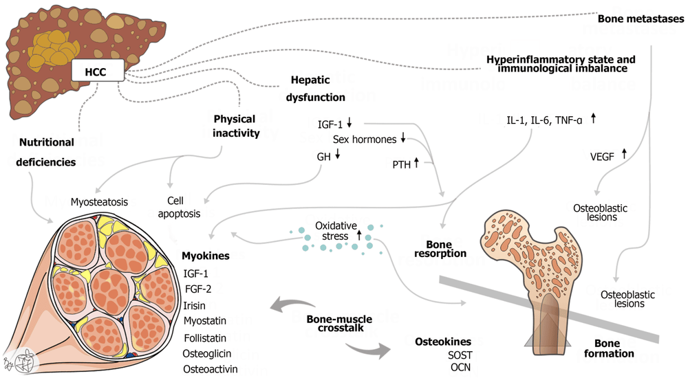 Sơ đồ biểu diễn các cơ chế bệnh sinh có thể có của những thay đổi cơ xương ở bệnh nhân bị bệnh gan. Trình bày các vai trò có thể có của nhiều yếu tố dẫn đến những thay đổi về cơ xương ở bệnh nhân ung thư biểu mô tế bào gan. HCC: Ung thư biểu mô tế bào gan; IGF-1: Yếu tố tăng trưởng giống insulin 1; FGF-2: Yếu tố tăng trưởng giống nguyên bào sợi 2; GH: Hormone tăng trưởng; IL: Interleukin; PTH: Hormone tuyến cận giáp; OCN: Osteocalcin; SOST: Sclerostin; TNF: Yếu tố hoại tử khối u; VEGF: Yếu tố tăng trưởng nội mô mạch máu