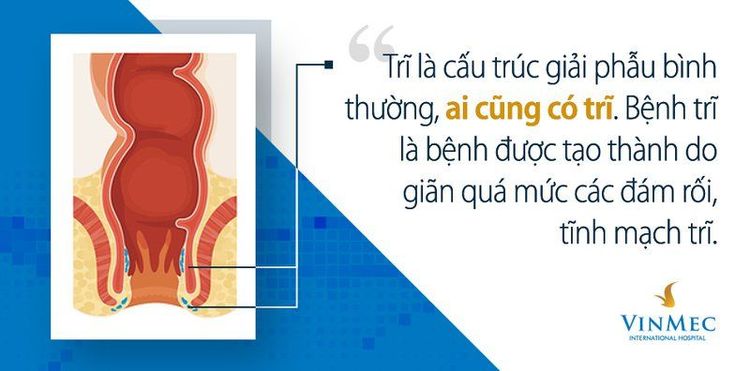 Bệnh trĩ và những điều ai cũng cần biết“giắt túi”