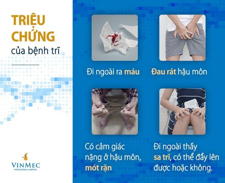 Bệnh trĩ và những điều ai cũng cần biết“giắt túi”