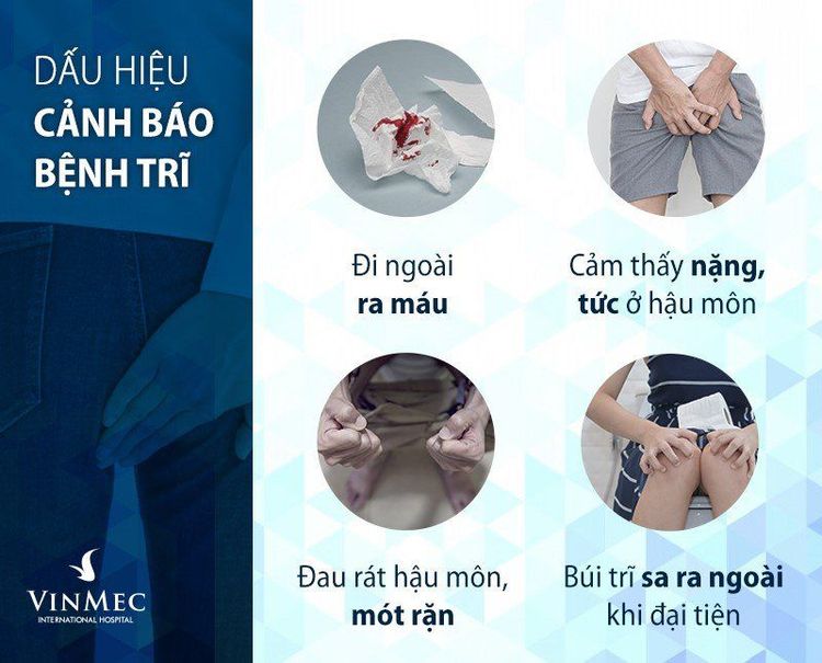 Các dấu hiệu cảnh báo bệnh trĩ. 
