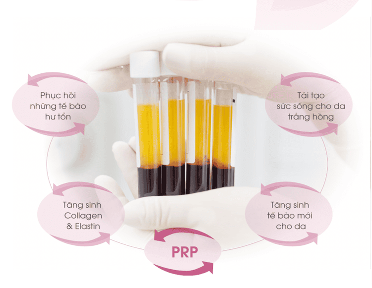 Things to know before using PRP skin rejuvenation