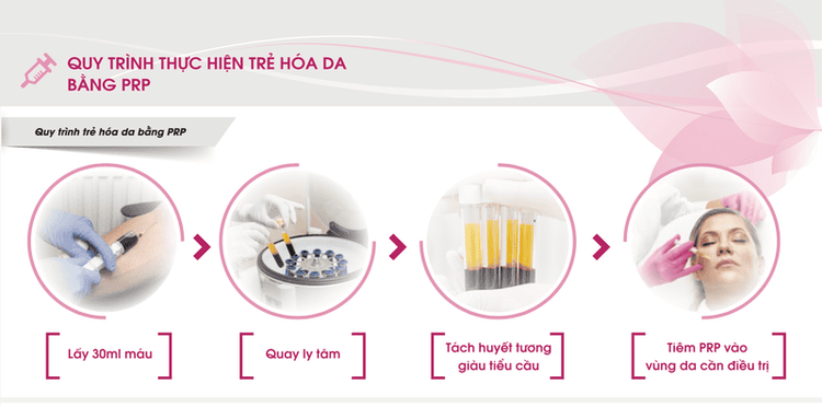 Quy trình thực hiện trẻ hóa da bằng phương pháp PRP.