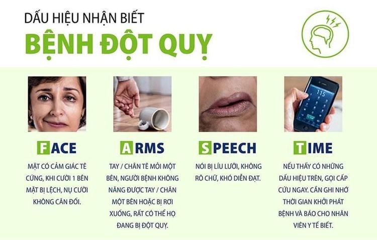 Đột quỵ não - Những điều cần biết