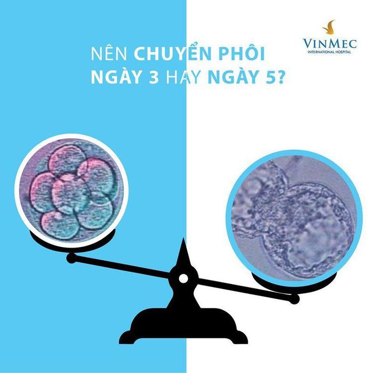 
Theo các thống kê, tỷ lệ trẻ sinh sống khi chuyển phôi ngày 5 cao hơn gấp 1,35 lần so với chuyển phôi ở giai đoạn phôi sớm
