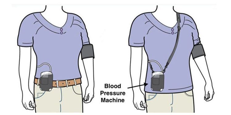 
Holter huyết áp đo huyết áp liên tục 24 giờ
