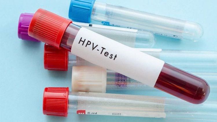 
Xét nghiệm Pap kết hợp với xét nghiệm HPV giúp phụ nữ phát hiện sớm các tình trạng tiền ung thư cổ tử cung
