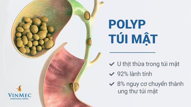 
Đa Polyp túi mật
