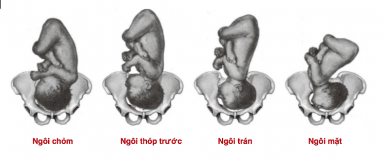 
Các loại ngôi thai dọc
