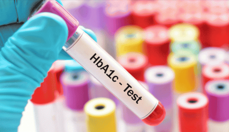 
Xét nghiệm HbA1c test
