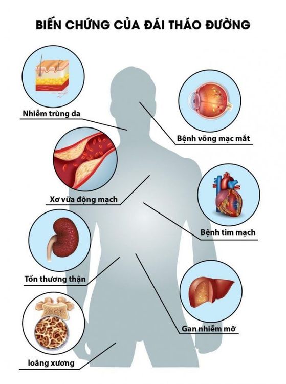 
Các biến chứng của đái tháo đường
